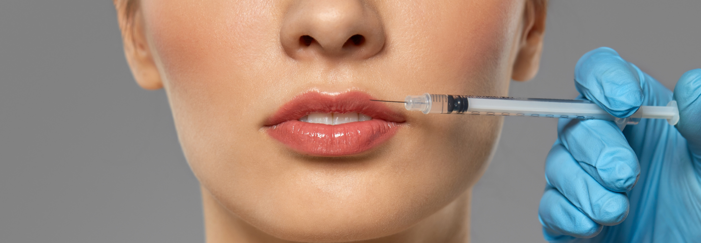 Everything You Need To Know About Lip Augmentation With Hyaluronic Acid
