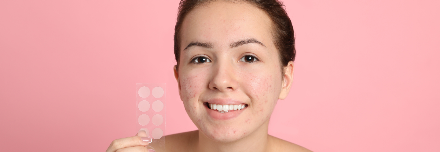 Is a Pimple Patch Effective in Treating Acne? — Articles — We Care For Skin