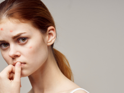 Achieve Acne-Free Skin: How Does Isotretinoin Treat Acne? 