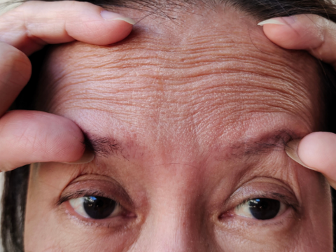 Skin Aging Tips: Mga Paraan Para Mabawasan Ang Kulubot Sa Mukha