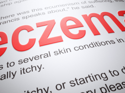 What is Eczema and  the Top Eczema Cream Options in the Philippines