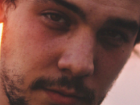 Melasma In Men: A Growing Concern 