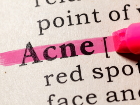 Debunking Acne Myths: Does Sleeping Late Cause Acne 