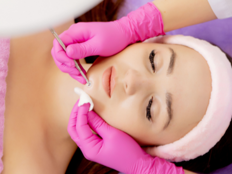 Debunking Acne Myths: Is Acne Treatment Expensive?