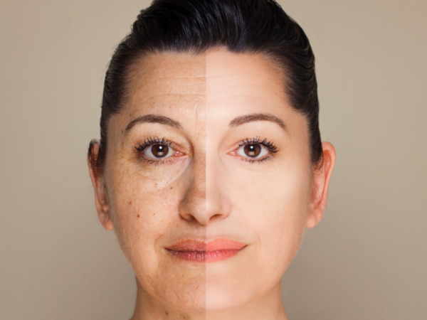Best Anti-aging Skin Products for 30s in the Philippines